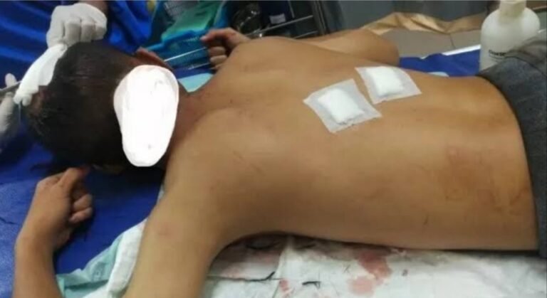 Seorang Pria Bersimbah Darah di Trotoar Tlogosari Semarang