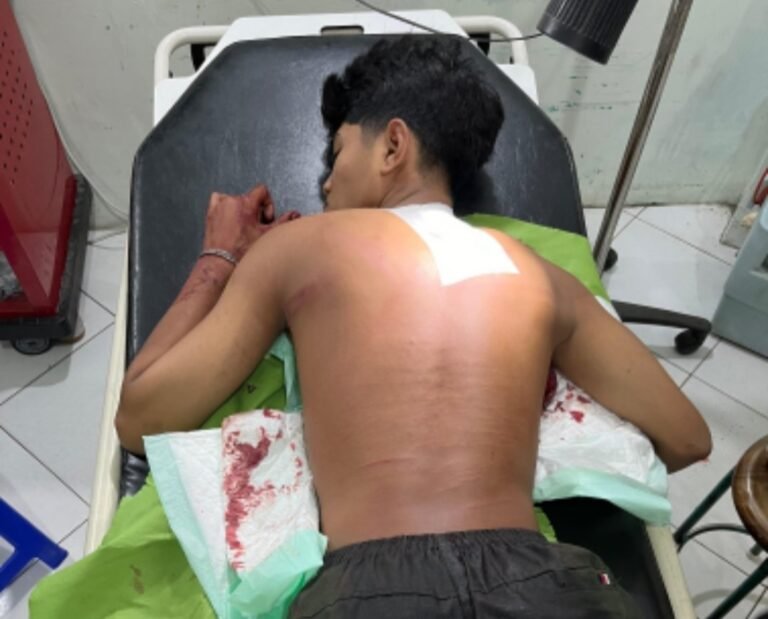 Gangster Berulah di Pati Tiga Orang Dibacok 